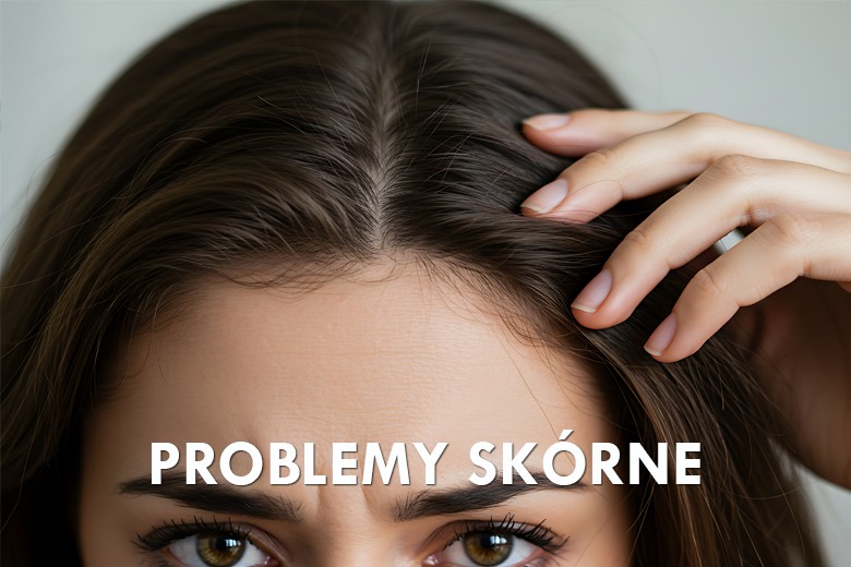 Produkty na problemy skóry głowy